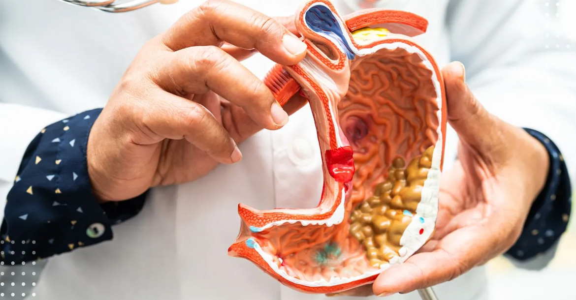 gastrointestinal-surgeries