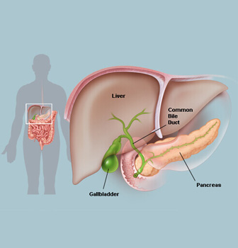 open-cholecystectomy